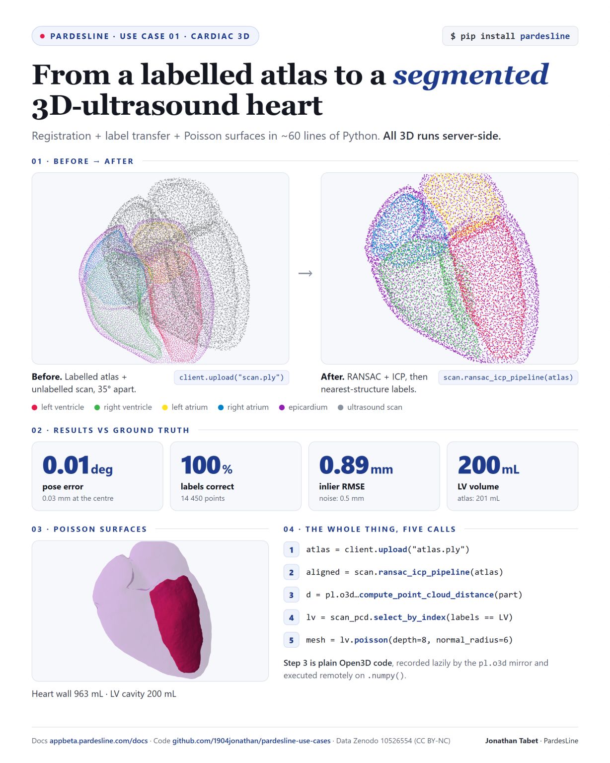 Atlas label transfer onto a 3D ultrasound heart