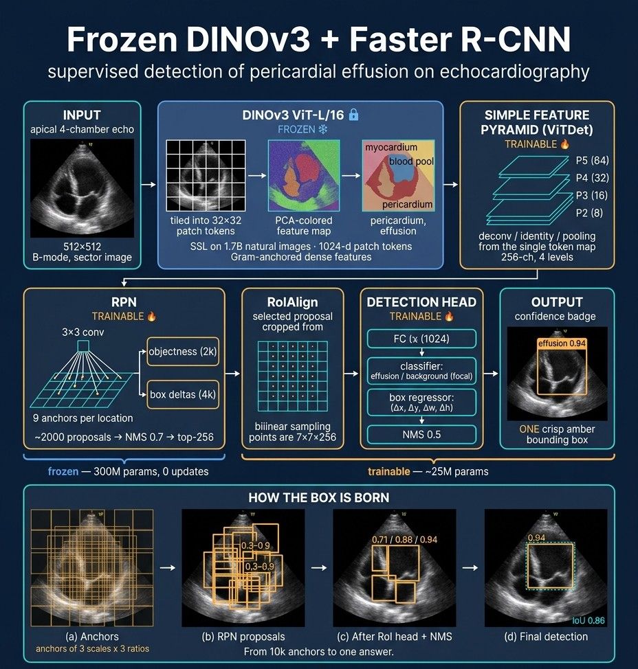 Frozen DINOv3 with a Faster R-CNN head detecting pericardial effusion