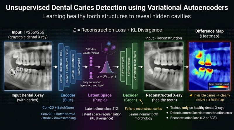 Unsupervised dental caries detection with a VAE